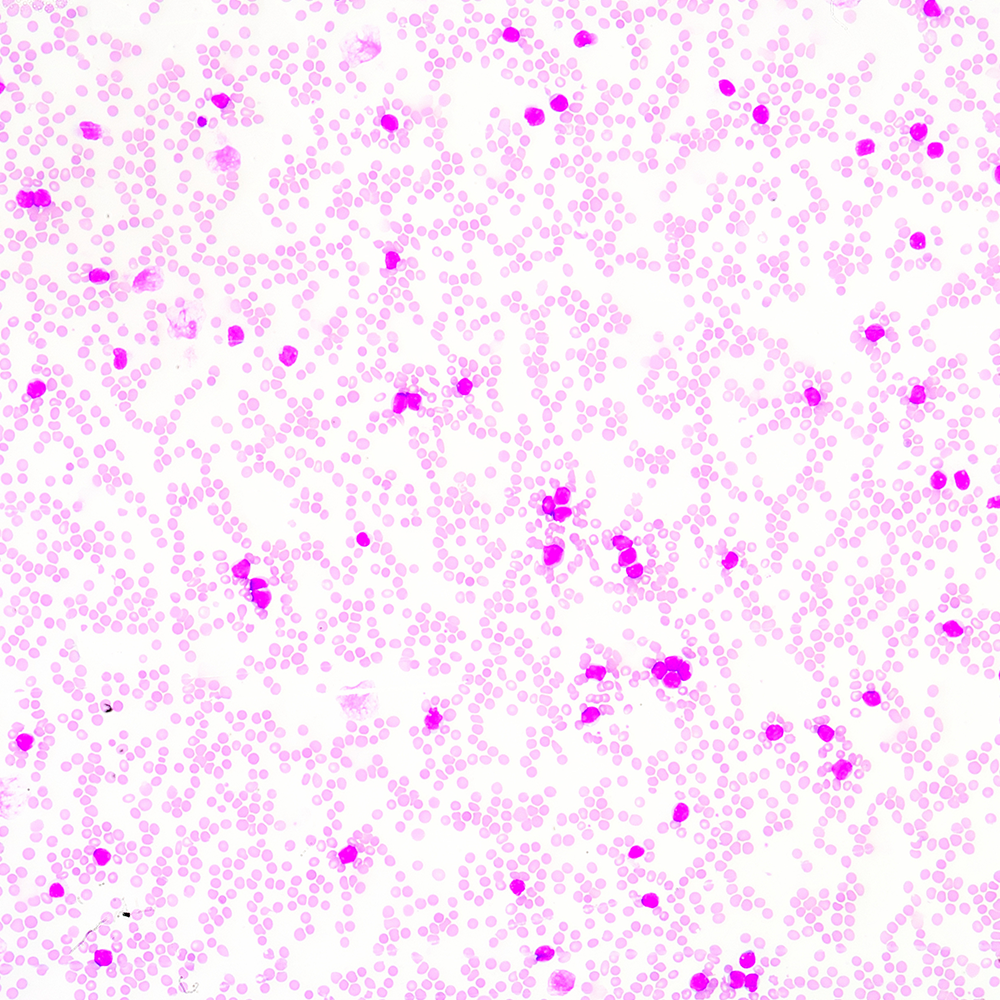 臺盼藍 VS AOPI：細胞活率計數，哪種染色更合你意？